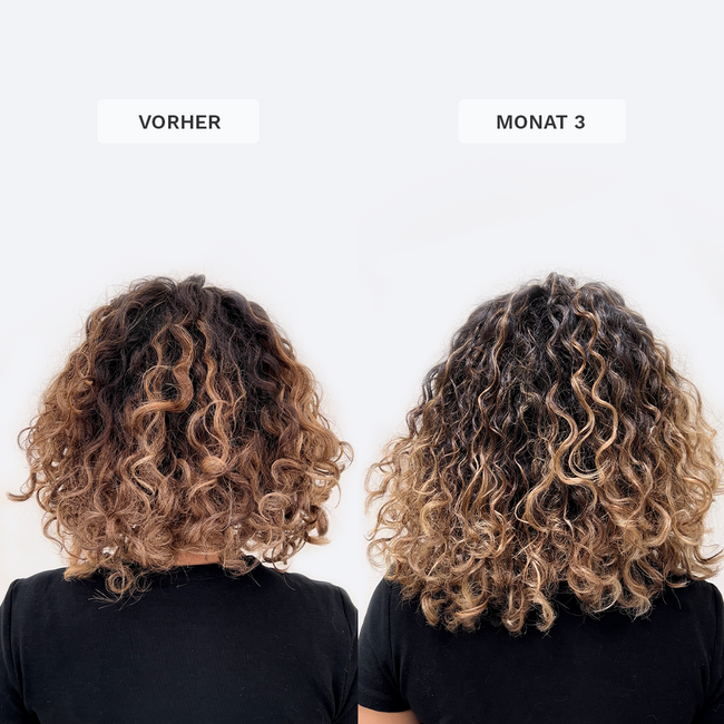 3. Bild von Fruchtgummi Haarvitamine